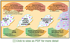Infographic (vector) for nutrition textbook: development of cancer cells